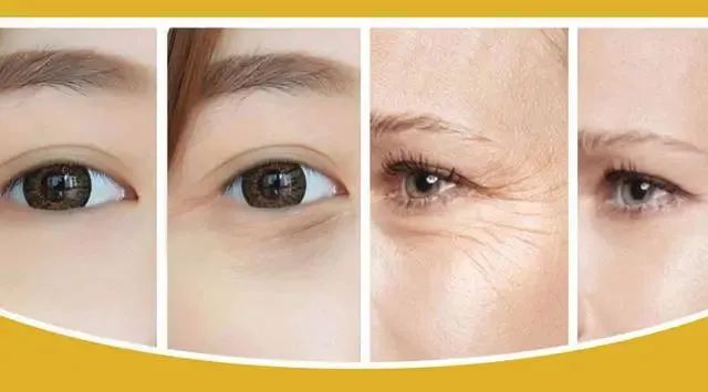 什么嗨体熊猫针是什么？一篇干货满满的「黑眼圈医美」分享