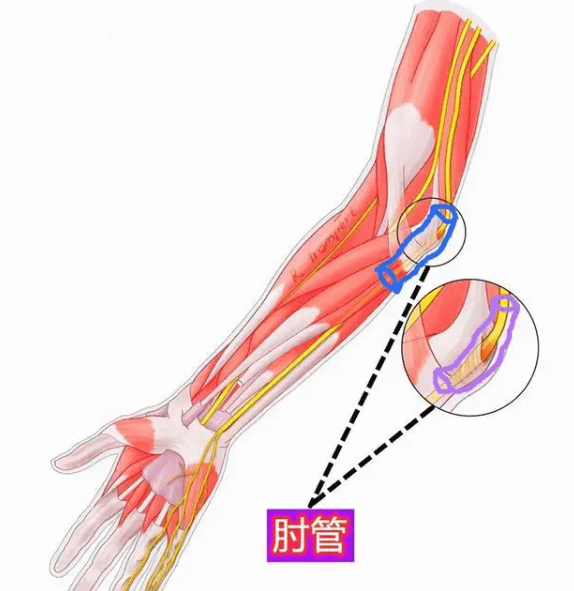 综合征|重庆治疗颈椎病 重庆红楼医院骨科