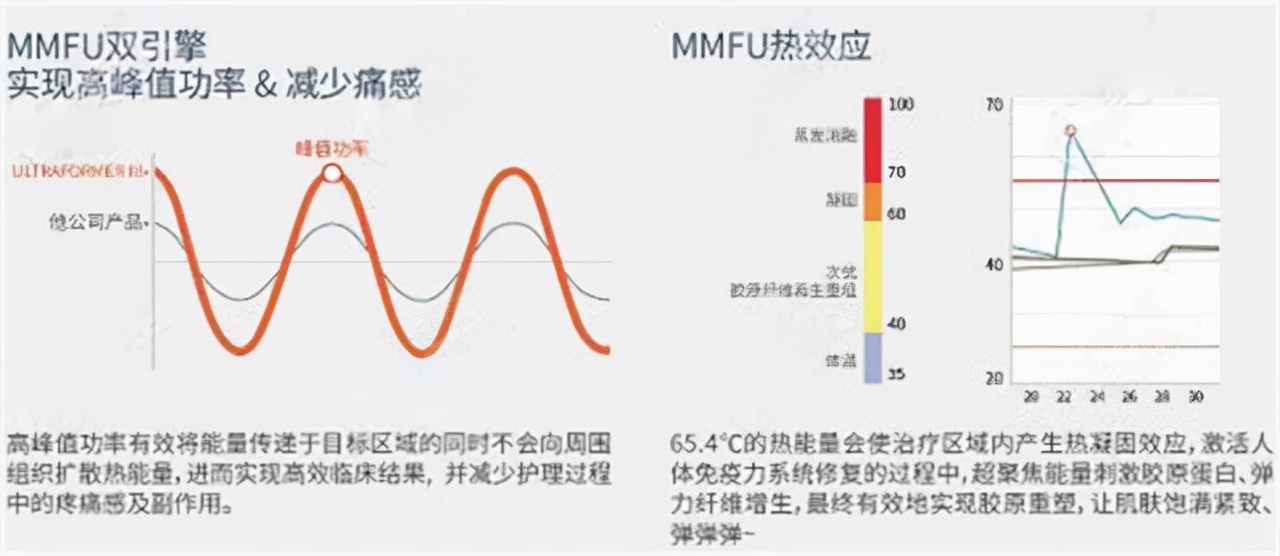 mm全面解析7d聚拉提的原理和功效适合多大年龄做~
