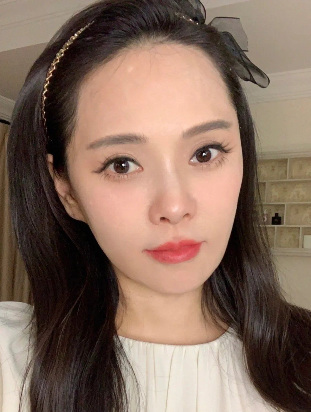 额头白点被疑整形后遗症伊能静亲揭真相