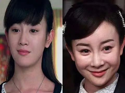 下巴明星审美误区，杨紫靠打针填充变“好看”，吴谨言追求“骨感美”