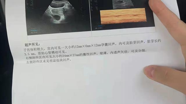 3dce45434ad54bfe831347e7fb183923.jpeg