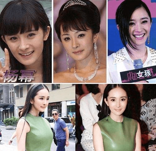 下巴整前似大妈、整完变少女？这些“回炉重造”的女明星，太成功了！