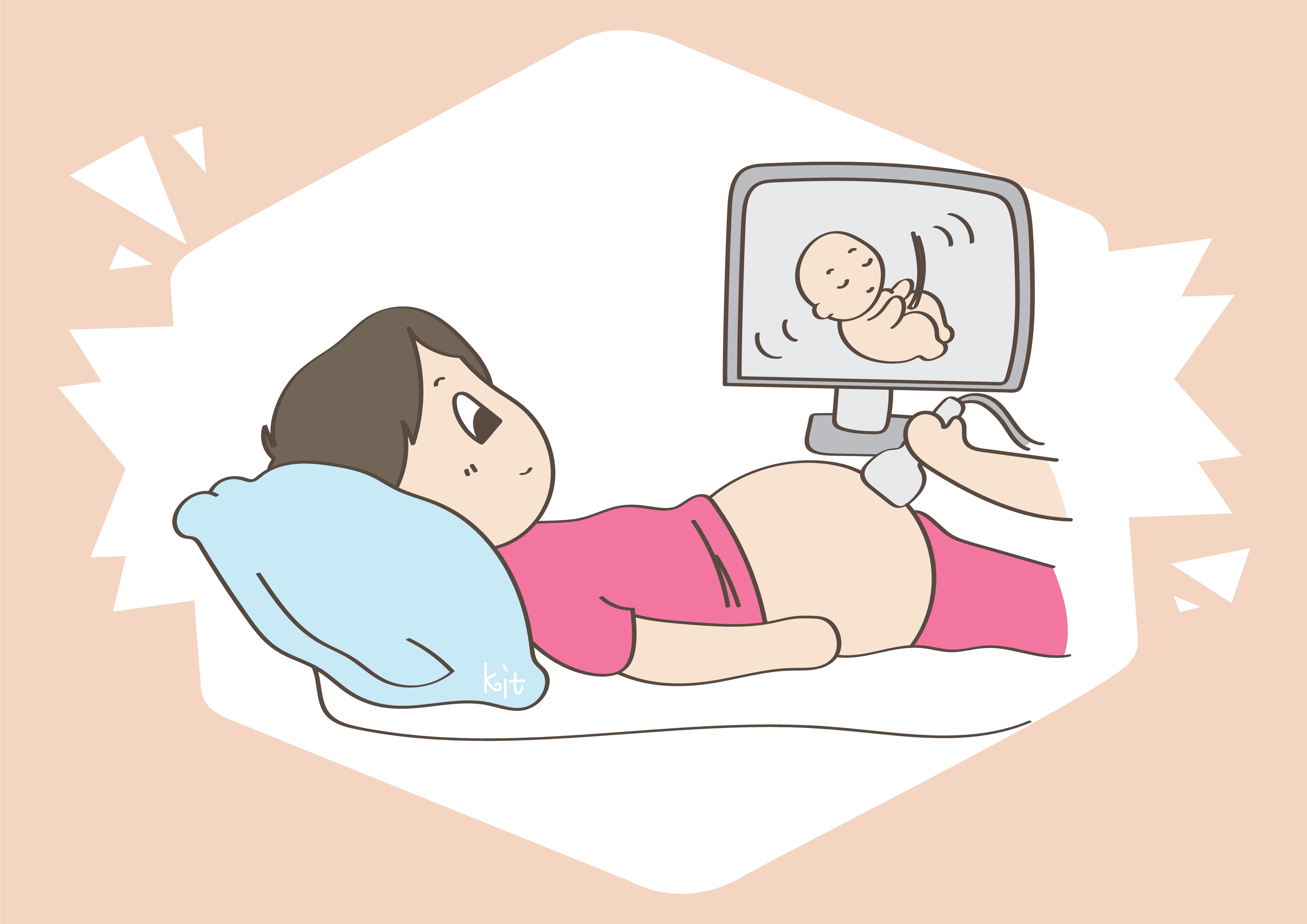 你做过妇检吗?孕期里的内检,被认为是最尴尬的检查_宫口_操作_情况