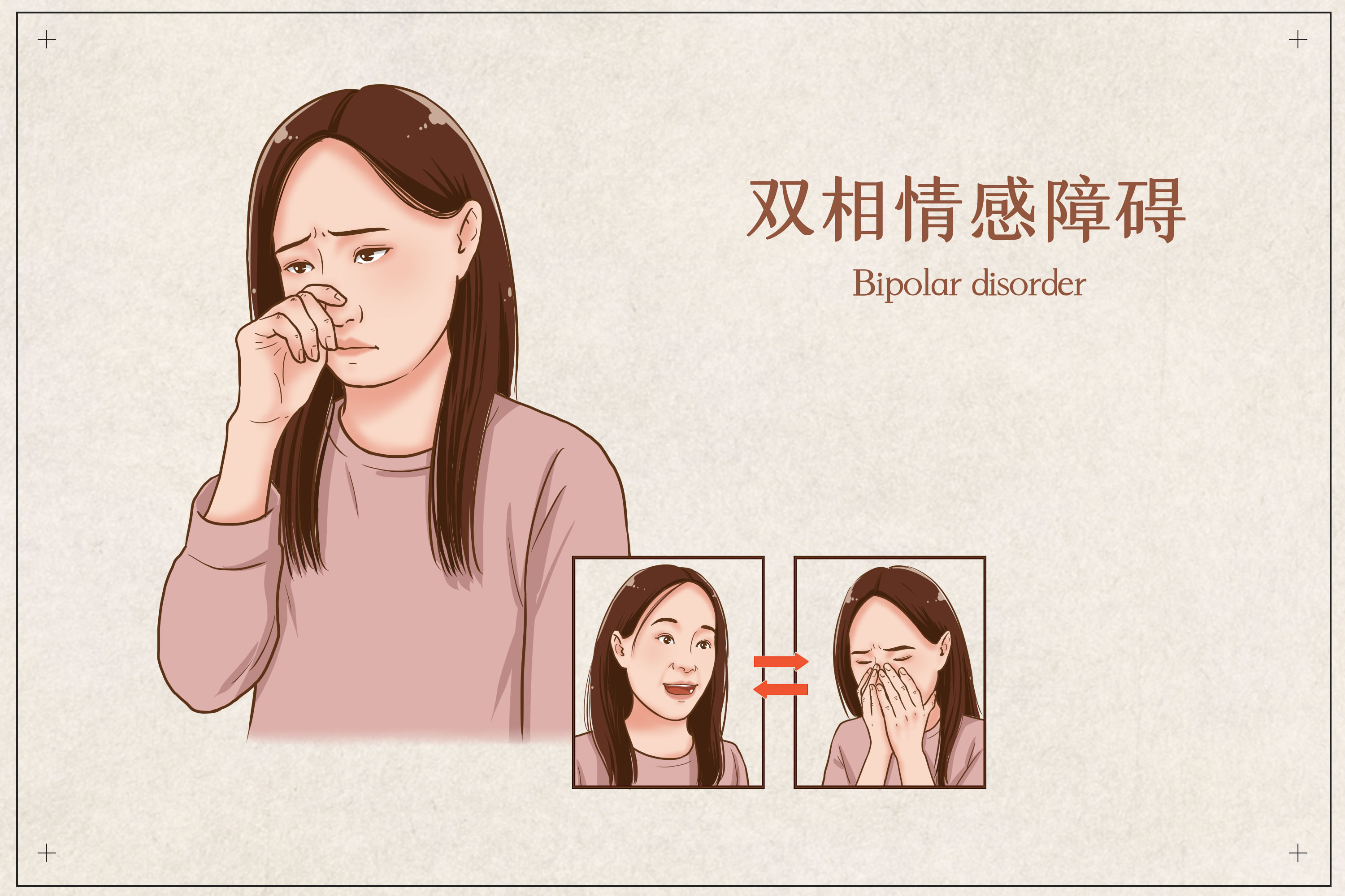 双相障碍是指既有躁狂或轻躁狂发作,又有抑郁发作的一类情感障碍.