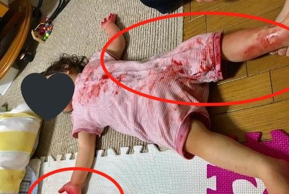 宝妈出门买菜不久，回家看到女儿躺在“血泊”中，没想到是恶作剧
