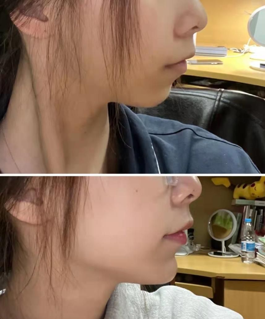 好看的下巴要符合哪些条件呢?_美学_标准_长度