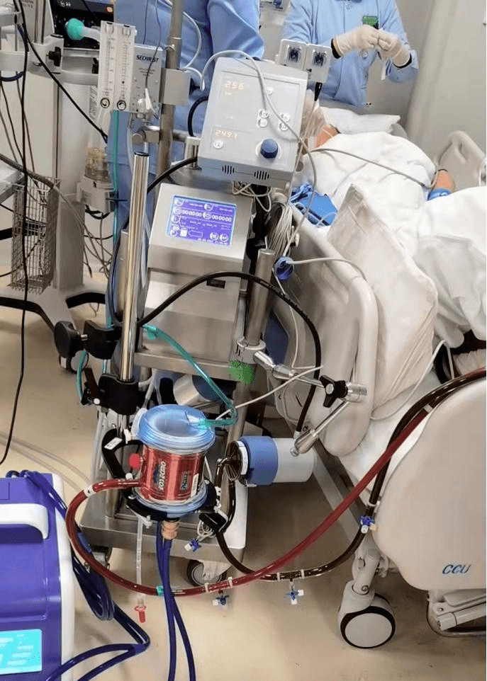 南阳医专一附院ecmo急救团队成功转运危重患者