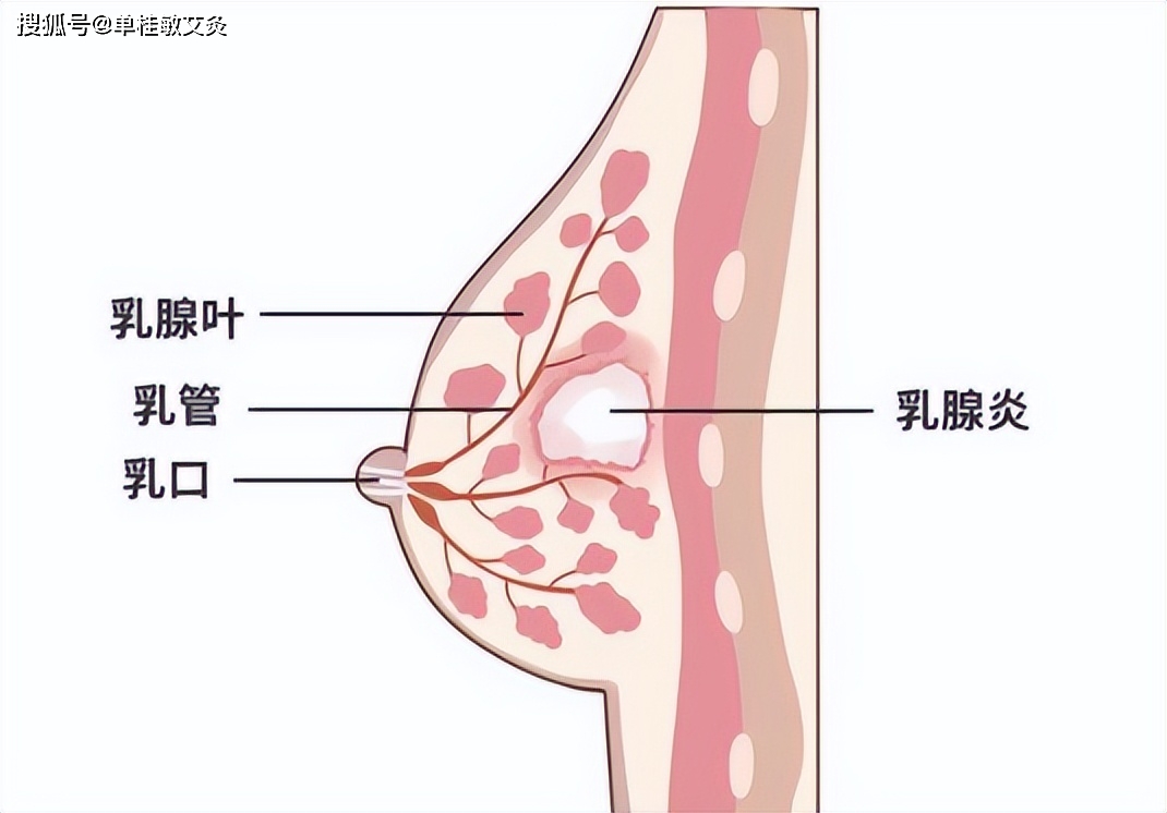 乳腺头尾位图片图片