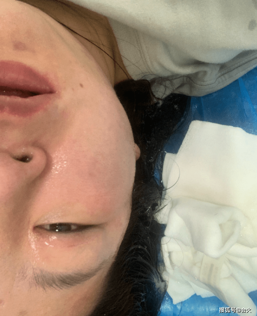 网红胡宾果网暴素人致其轻生 曾5年整容300次 他算什么真性情 网友 月经 朋友