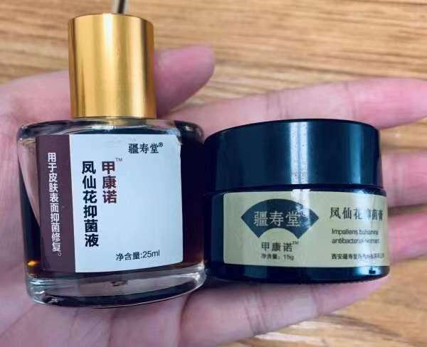 灰指甲患者不要错过康复者分享治疗经验确定不看看吗