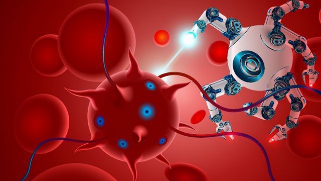 修复变形体内取异物现实版毒液机器人问世