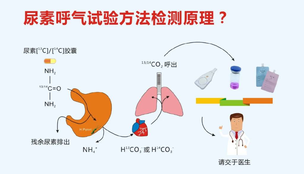 在幽门螺旋杆菌,则分解尿素,产生同位素标记的co2,在呼出气体中检测到
