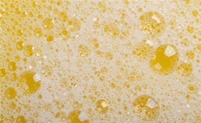 原创尿毒症是怎么来的医生提示如有2处发臭晚上最好坚持3不要