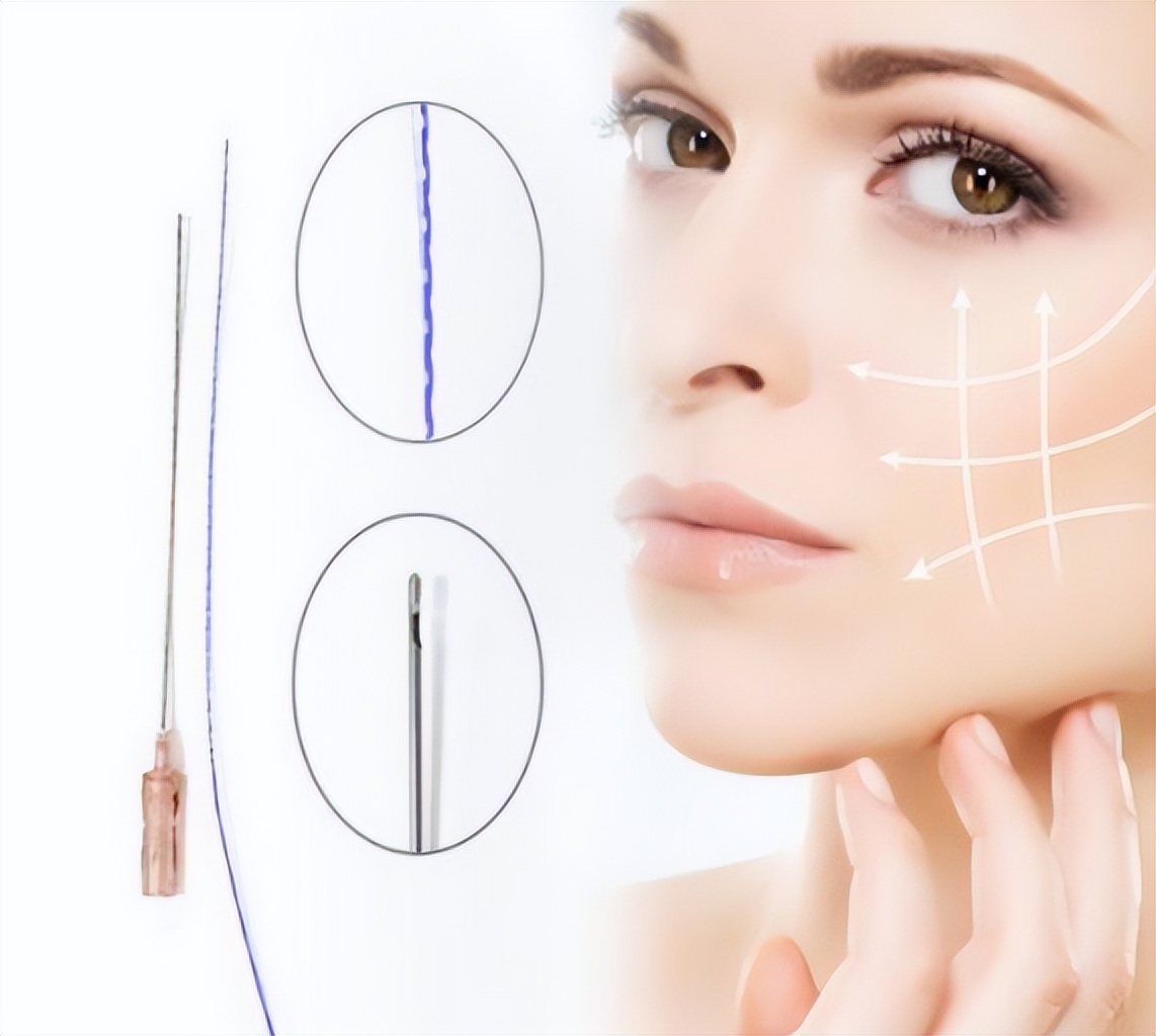 深扒线雕可以保持多长时间线雕一生最多能做几次到底值得做吗