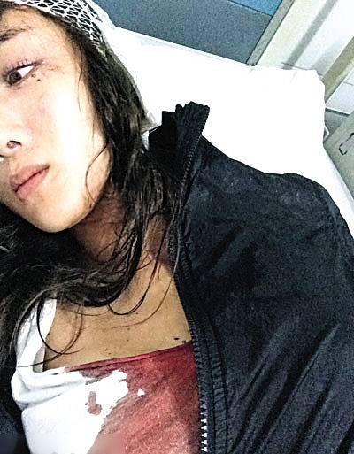 原创李依晓被狗咬伤脸毁掉前途至今没得到一句道歉凭饰演反派翻红
