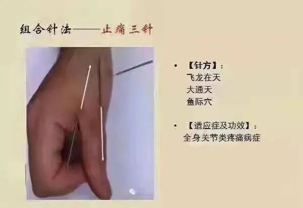 腰疼针灸扎手图片