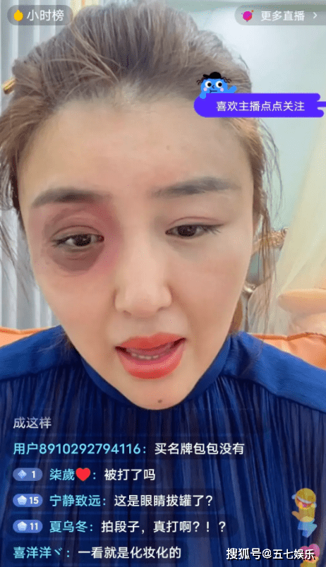 被前夫家暴,右眼被打黑青,或和赵本山坑其前夫投资有关_长春_眼睛_七