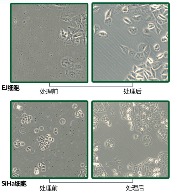 細胞實驗中細胞受到原蟲汙染後,培養基輕微渾濁,鏡下可以觀察到眾多的