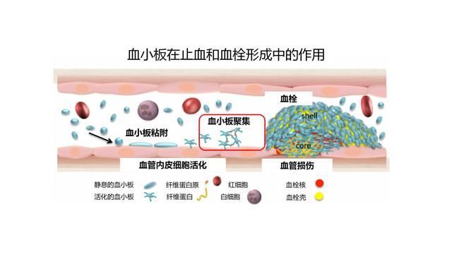 血小板聚集血小板聚集的整个过程就是吸引更多的血小板到损伤处,并且