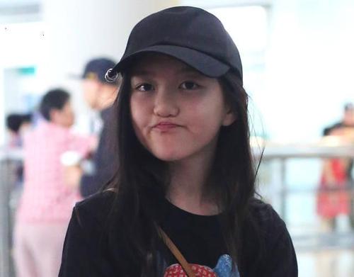 李亚鹏女儿天生兔唇却让人同情不起来只因她是天后之女