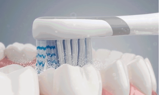 电动牙刷的优点与缺点，口腔博主分享避坑指南！