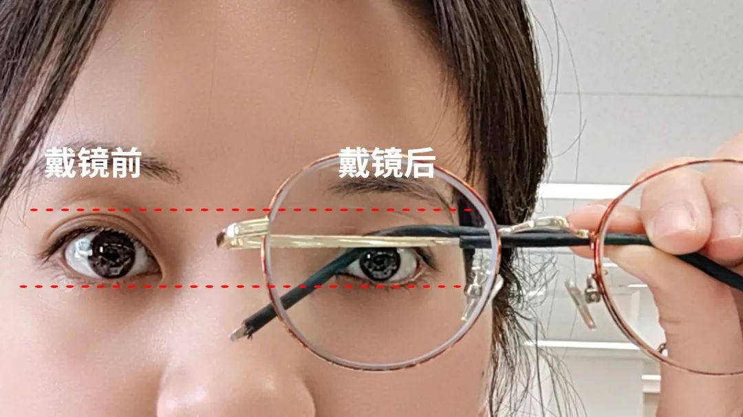 近视有哪些矫正方法?_框架_度数_眼睛