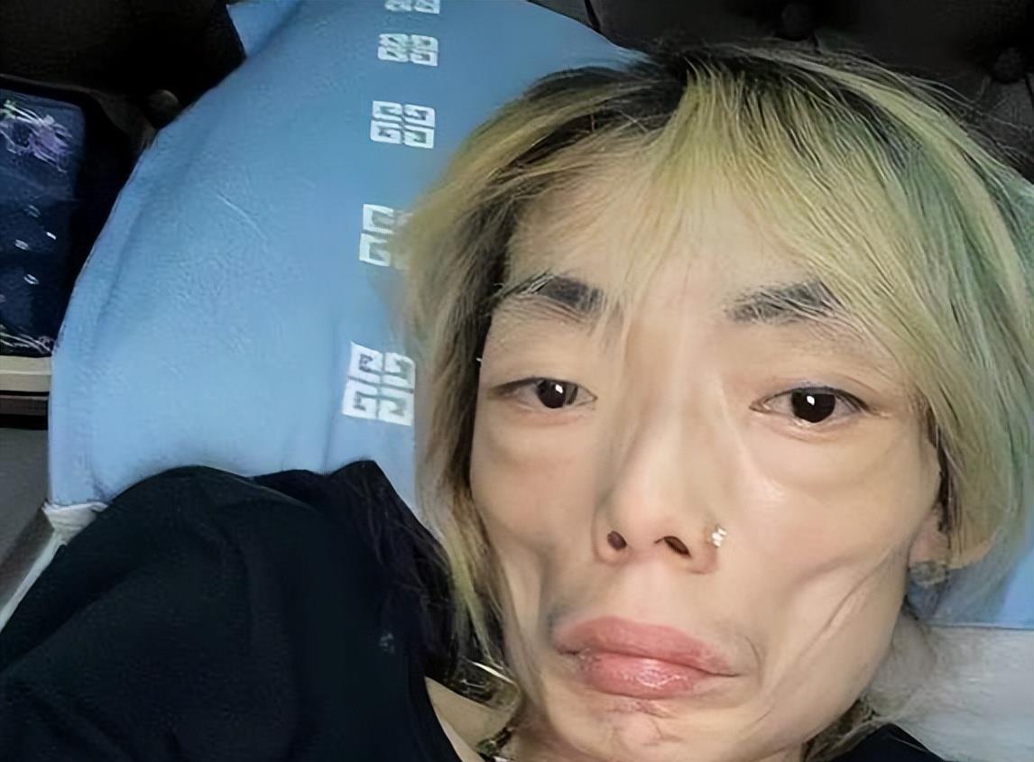瘦到脱相动脸成瘾体重仅剩44斤内娱的病态审美真可怕