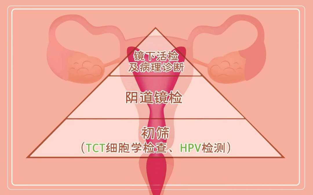 宫颈癌筛查还做不?_进行_女性_疫苗