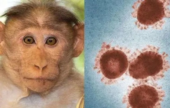 如何�A防猴痘？如何�A防�c治��猴痘？