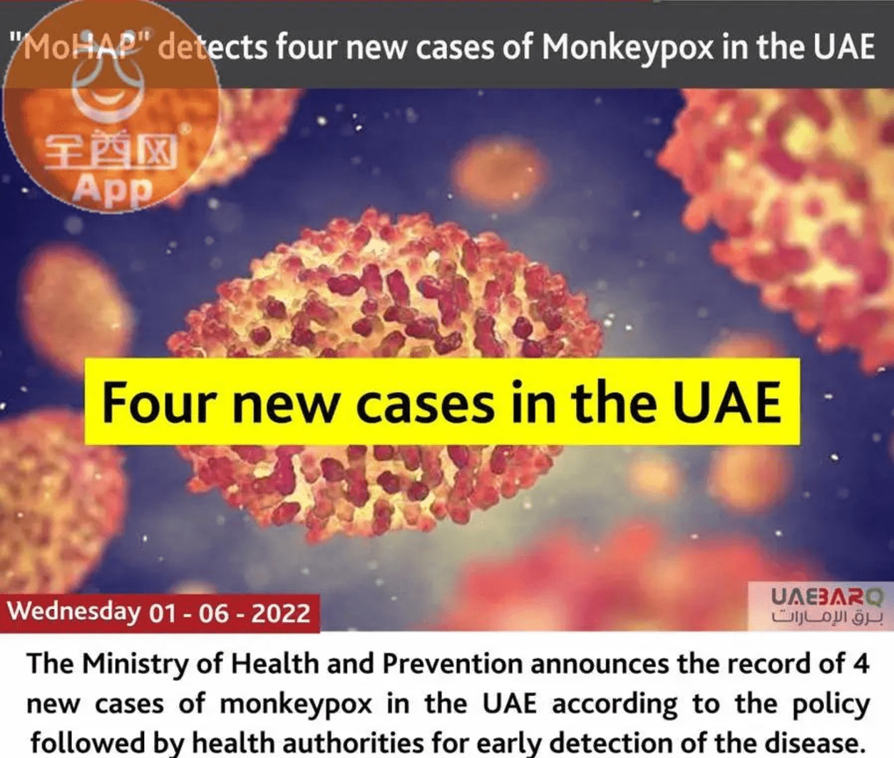 阿联酋宣布4例新的猴痘病例 