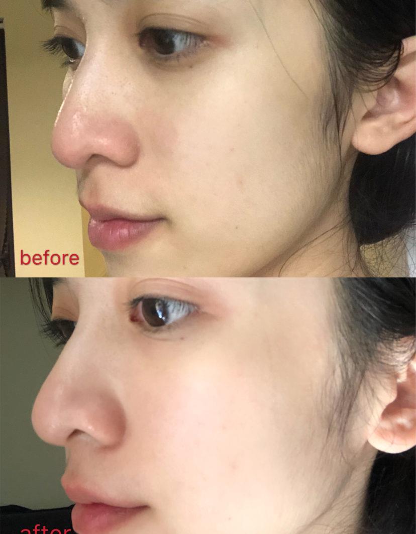 3位女星出道前后对比,最后一位差距最大,仿佛换了一个人_美容_皮肤