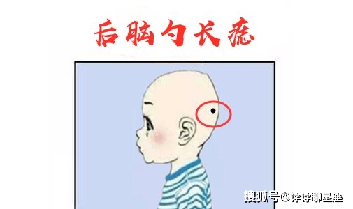 后脑勺长痣在相学中,后脑勺的位置就是我们所说的枕骨,而若是在枕骨的