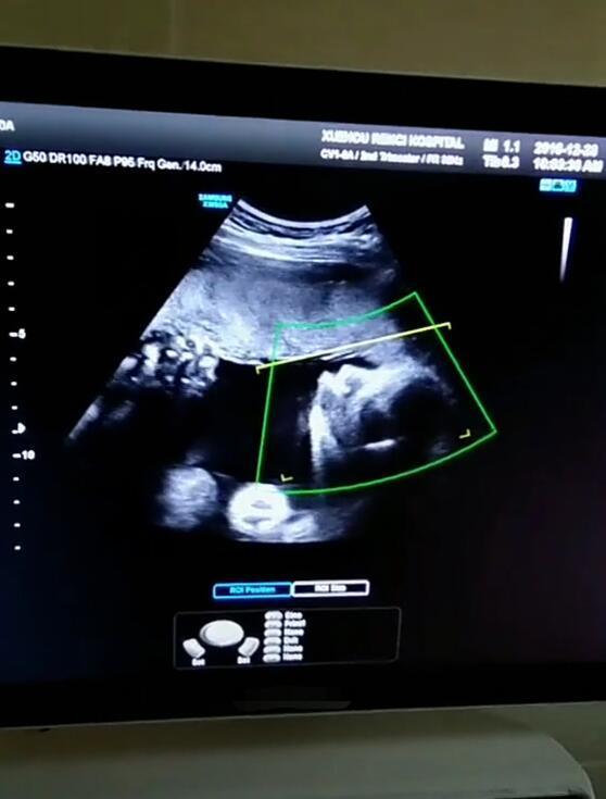 16周胎儿b超图片