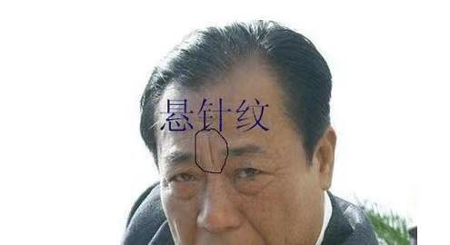 额头悬针纹男人的面相_命运_相由_气运