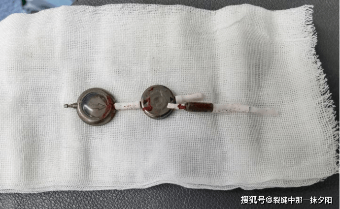 为什么有些脑积水患者分流术后效果不理想