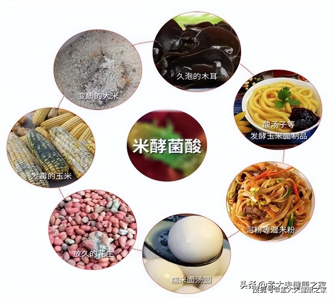 严重者还有可能引发诱发肝肾损伤,而且米酵菌酸毒素这种脂肪酸具有耐