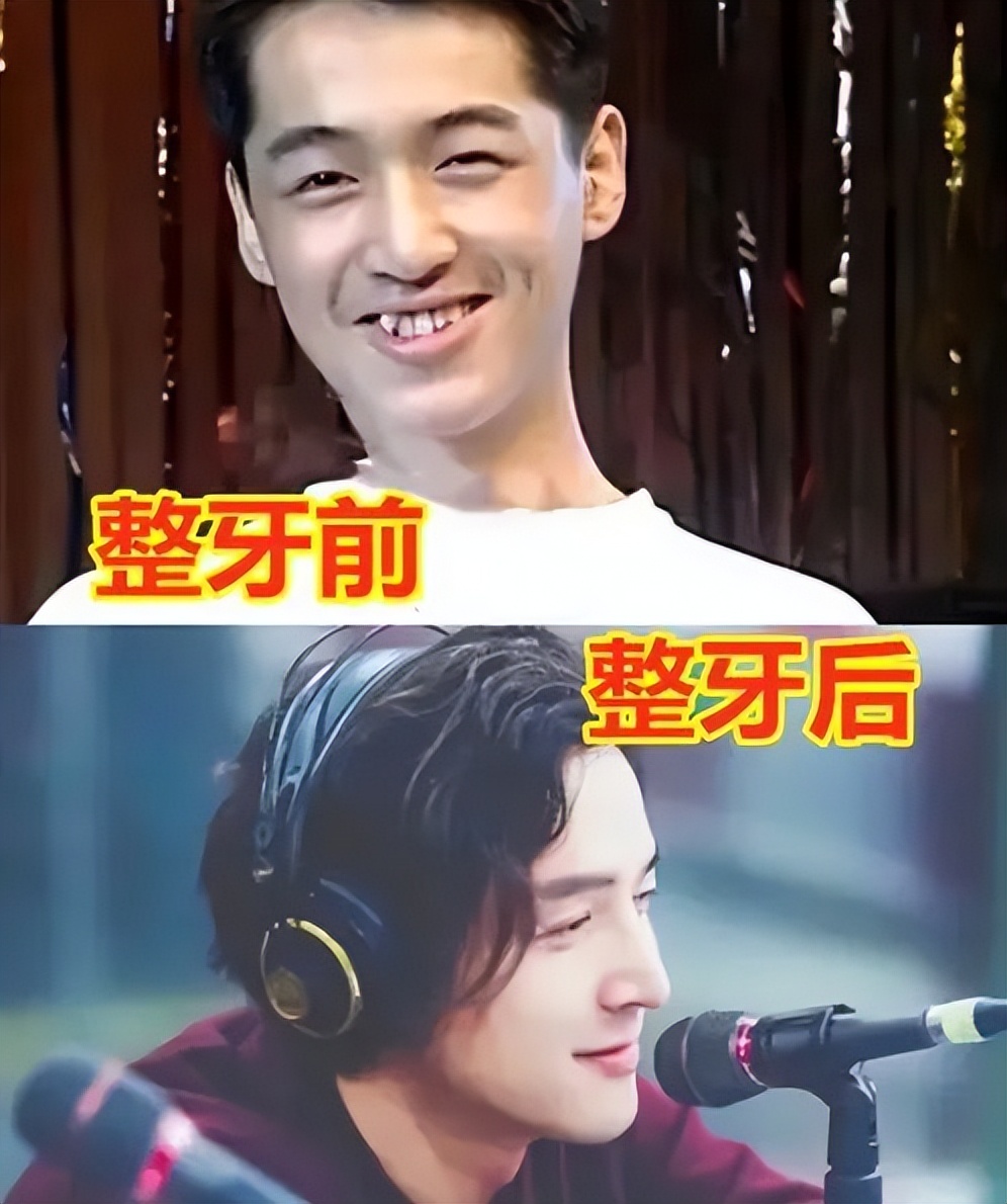 说刘亦菲丑的,别拿"畸形审美"绑架她_牙齿_女儿_小沈阳