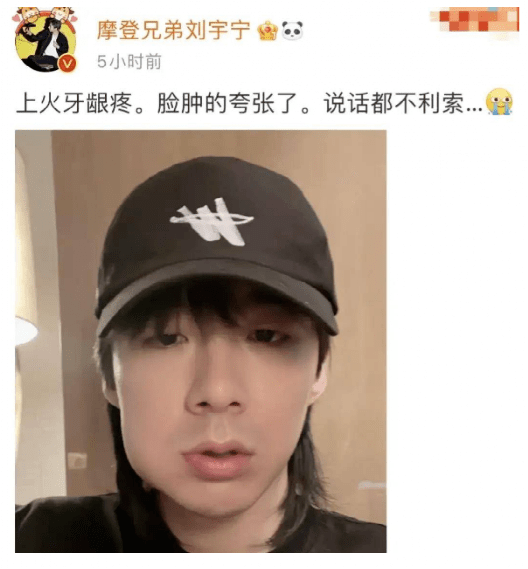 "叫拔智齿,周冬雨圆润发肿,看到黄晓明我忍不住笑了_乔欣_刘耀文_刘宪