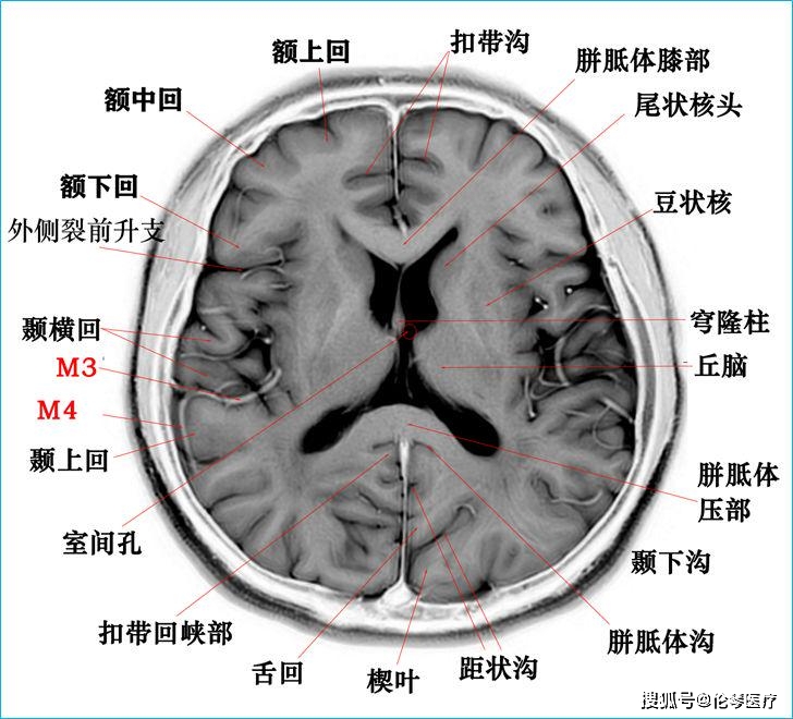 高清颅脑断层解剖图谱【磁共振 大体标本】
