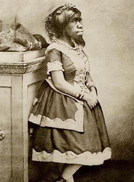 原创墨西哥女子幼年丧母因外貌奇丑成圈钱工具死后遗体还被巡展