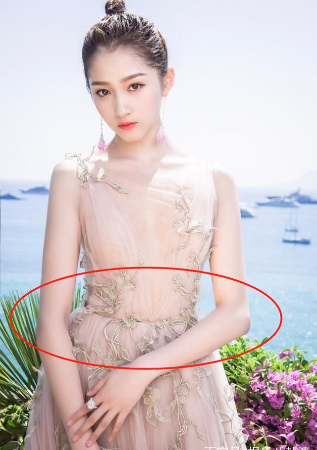 原创关晓彤故意的吧继7个指头生西瓜后又整出白癜风和变异