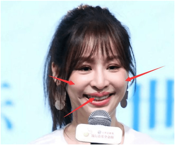 原创9位被整容硅胶脸害惨的好演员蔡明脸肿嘴歪刘晓庆笑不出来