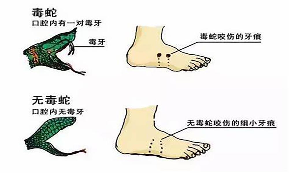 梦到被蛇咬到腿，深层次心理与文化征兆的解析