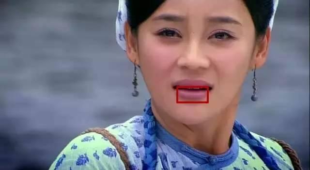 忍着剧痛做了玻尿酸丰唇,却变成了香肠嘴,明星翻车现场……_嘴巴_厚