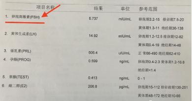 卵巢早衰是指卵巢功能衰竭所致的40歲之前即閉經的現象,特點是原發