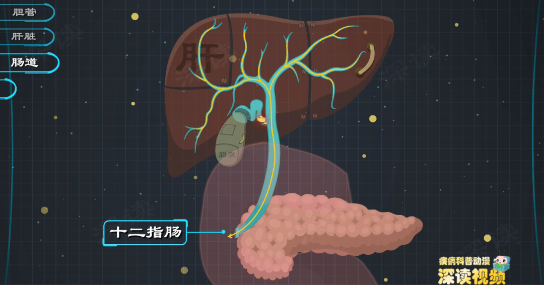 膽管結石是怎麼搞壞你的肝膽腸胰的畫得太棒了