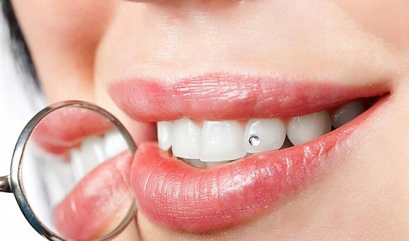 【牙龈出血】牙龈出血是什么原因_牙龈出血怎么办