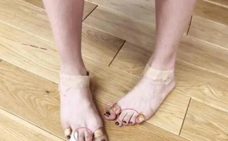 原创女明星的脚多可怕王子文脚残志坚她不得不去矫正