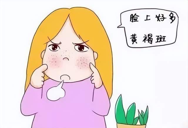 科普丨黄褐斑是怎么形成的